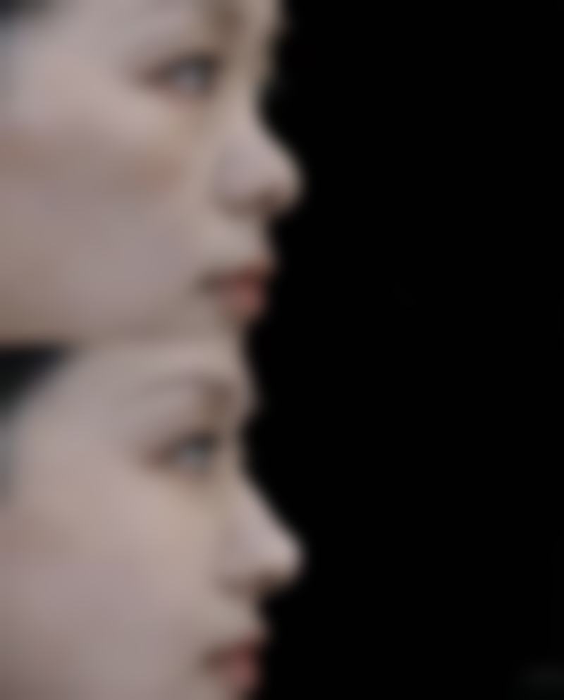 周其光医生简介做手术价格