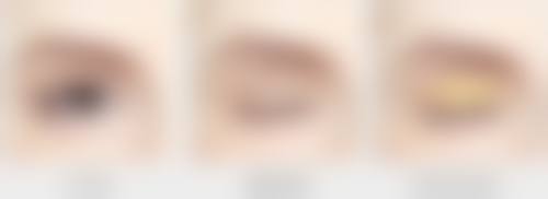 疤痕有什么方法可以去掉——中医篇：古法“调理”，内外兼修