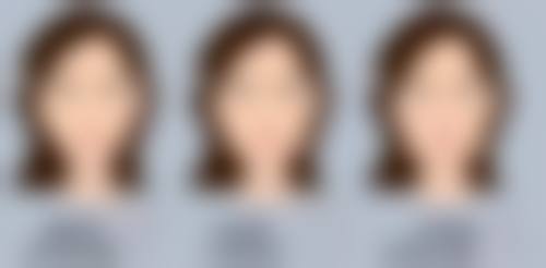 尾段：下垂脸不是终点，而是新起点！