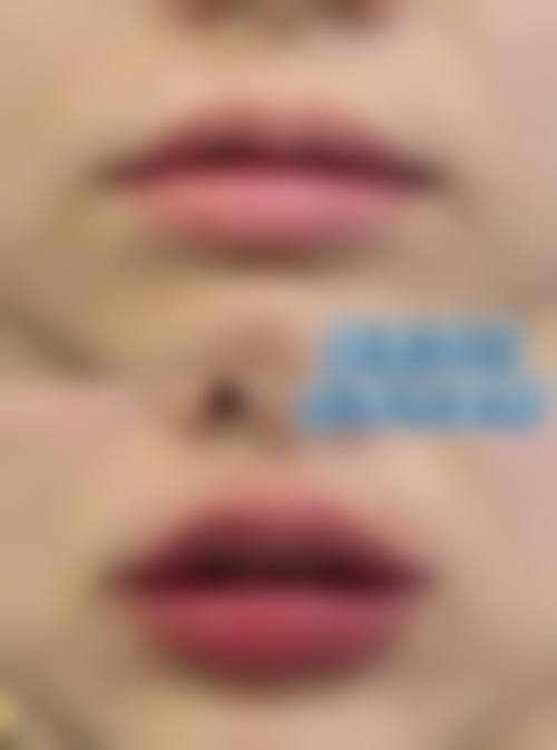 成都武侯菲瑞莎整形医院口碑评价如何