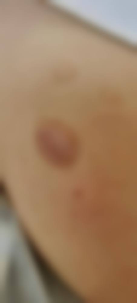 杭州悦可医疗美容诊所陈彩媛收费贵不贵——口碑评价