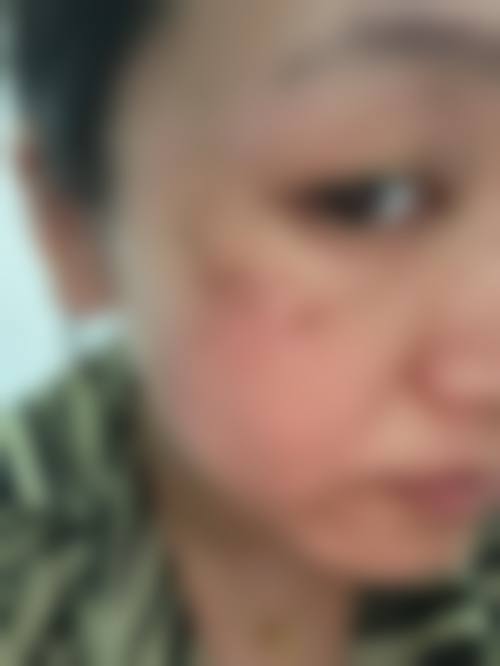 无锡臻美医疗美容是否正规