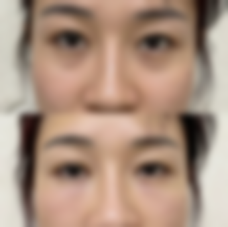 杨登峰医生简介项目优势