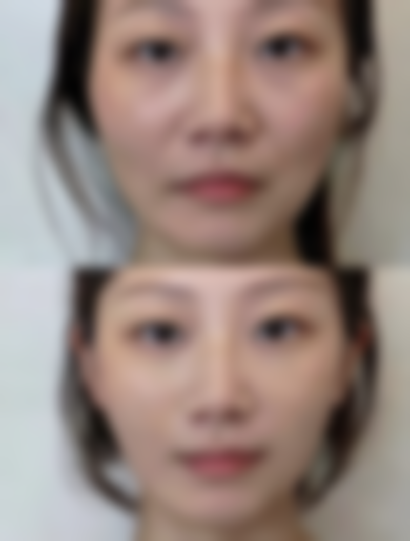 尾段：选择适合自己的方式，和疤痕说再见