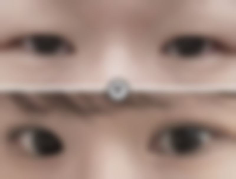 杨登峰医生简介做手术价格