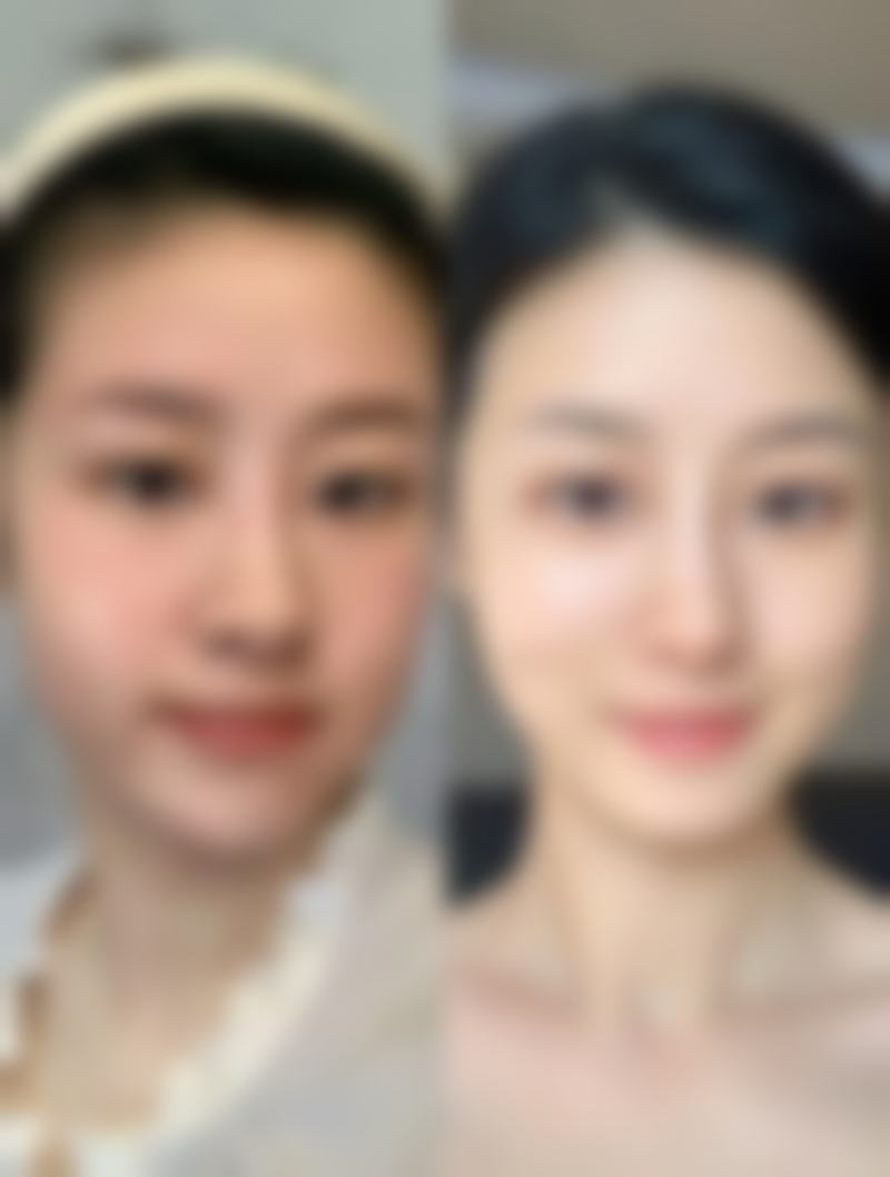 杨登峰医生简介口碑如何