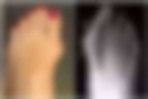 老年人下眼袋大是否正常的判断