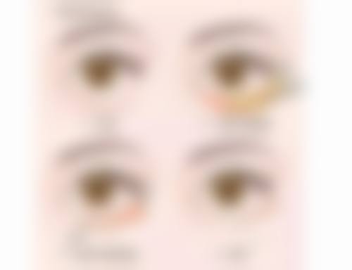 周玉成医生怎么样