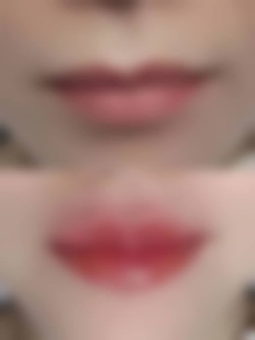 深圳奥觅诊所医疗美容科怎么挂号,地址在哪儿