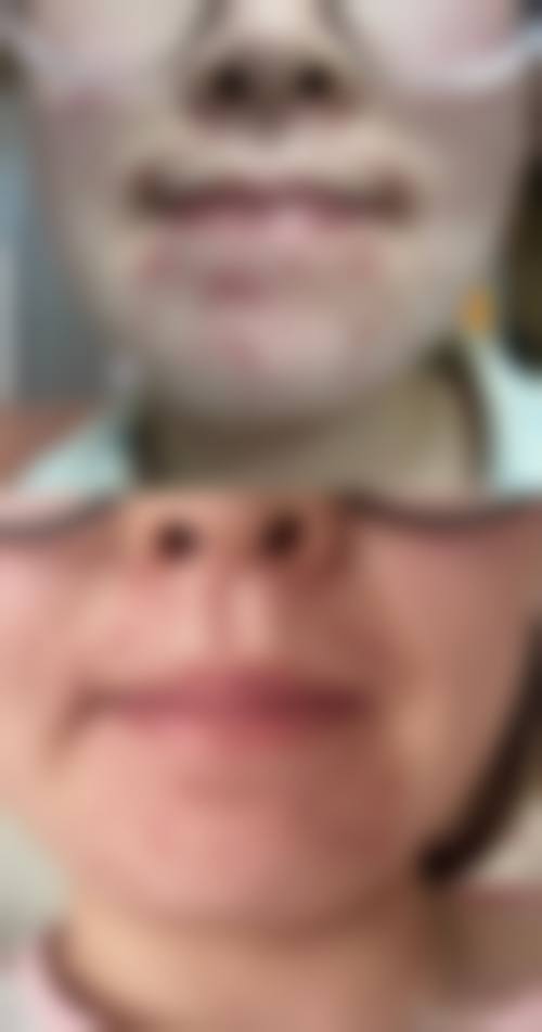 达州觅己医疗美容诊所价格表