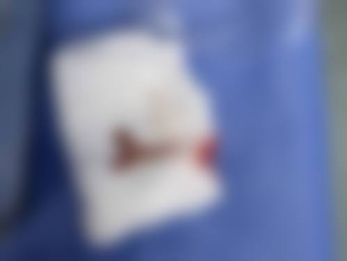 深圳素仁医疗整形美容门诊部顾客实例