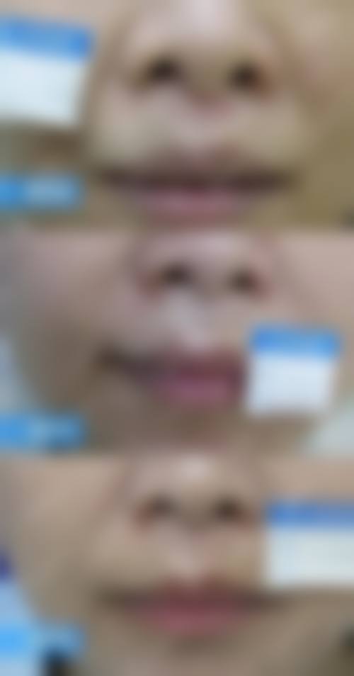 上海纽赛医疗美容门诊部价格表