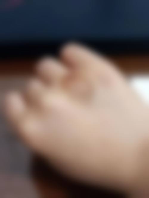 林汉文医生做手术价格