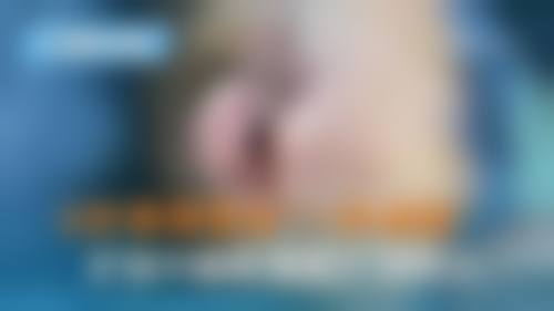 2026江岸区医美收费价格表中的热玛吉医美收费市场深度分析