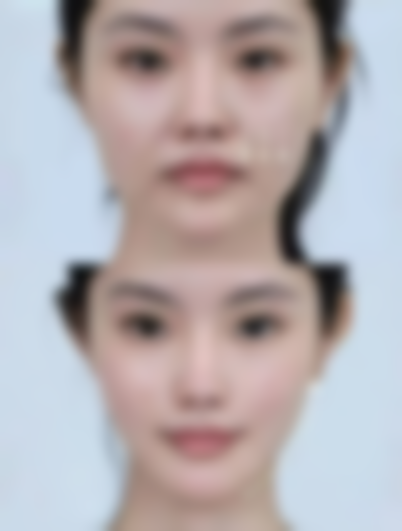 去除黑眼袋用什么——中药篇:内调外养双管齐下