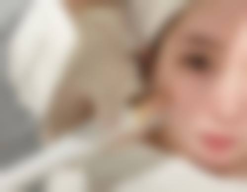 割双眼皮改善眼皮松弛的风险与应对措施