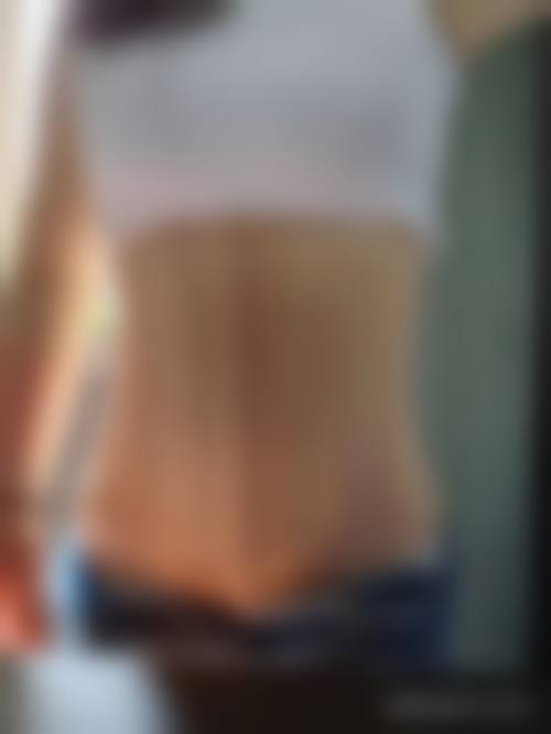 杭州悦可医美激光脱毛顾客实例