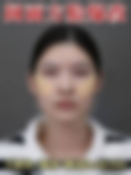 天津津南紫爵妙韩医疗美容诊所价格表