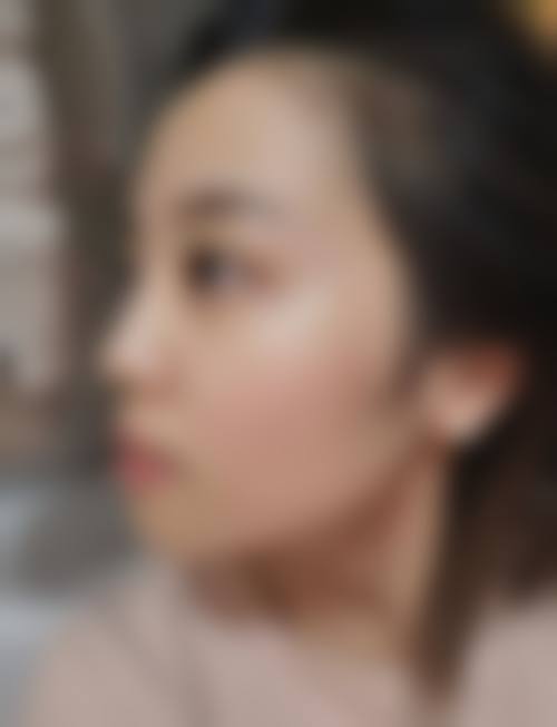 扬州俏华美医疗美容诊所高军飞医生价目表2026——扬州明康眼科医院专精度