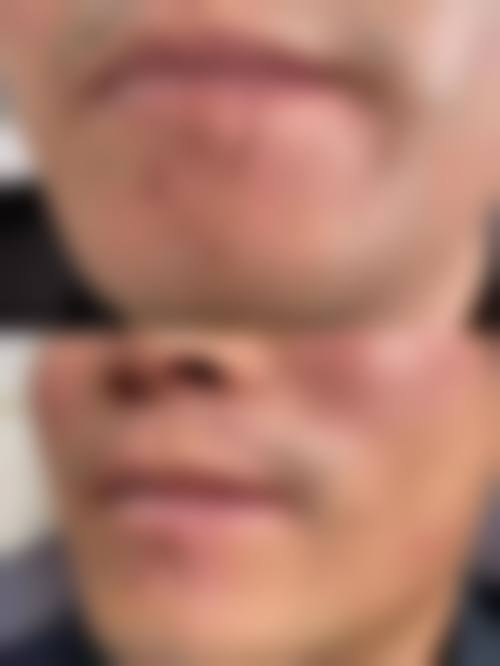 盘锦北芳医疗美容诊所价格表