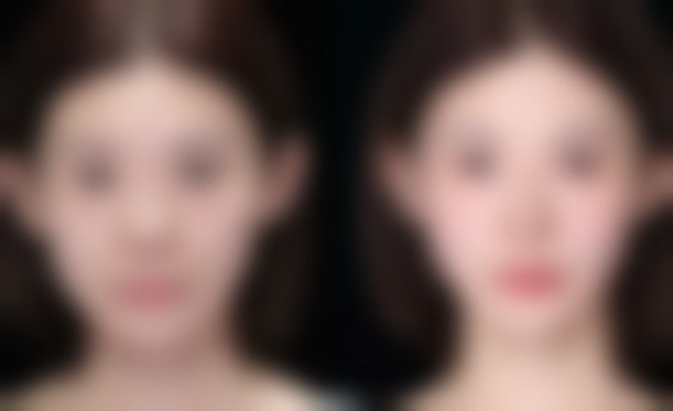 内双眼皮适合欧式双眼皮贴的风格与使用建议