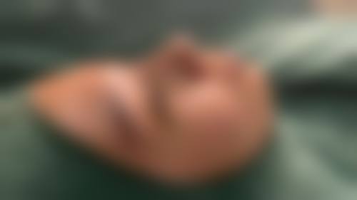 苏开新医生简介做手术价格