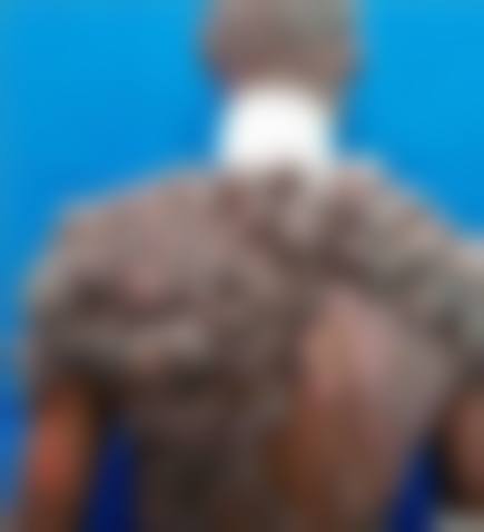 上海港华整形医疗美容医院怎么样，口碑评价如何？