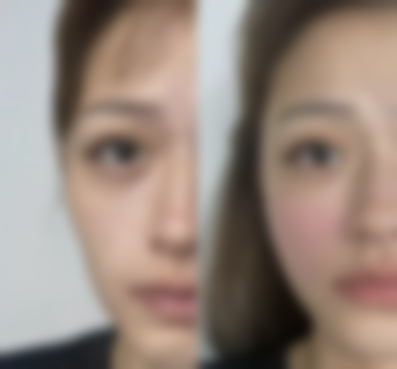 邢晓华医生做手术价格