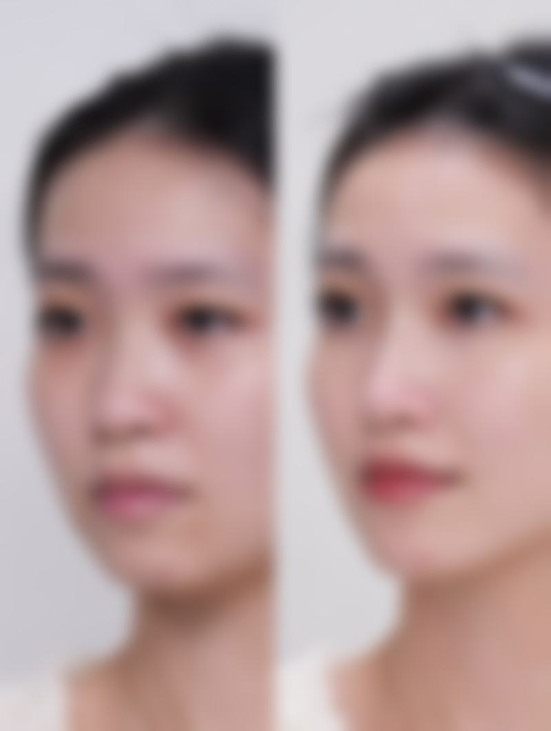 武汉斯启诺医疗美容门诊部董雷好预约吗——江城整形