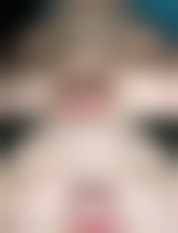 郑州美智慧医疗美容诊所怎么样更擅长什么