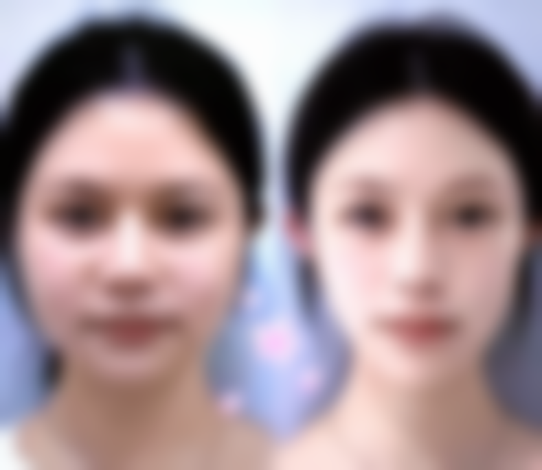 阳光诊所六本木院怎么样？更擅长的手术项目