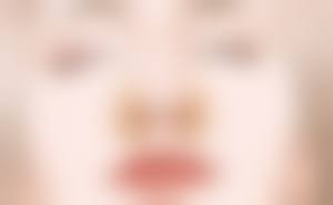 总结:假体隆胸+哺乳 ≠ 必然下垂!