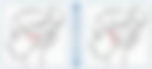 疤痕疙瘩激光治疗适合所有人吗