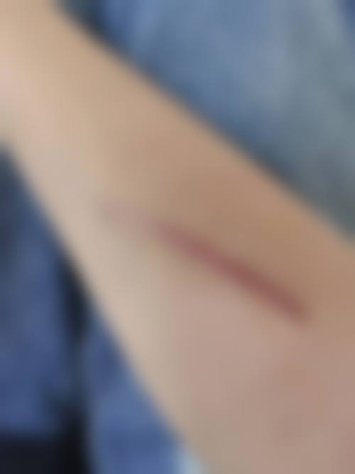 成都集佳整形医疗美容诊所更擅长什么