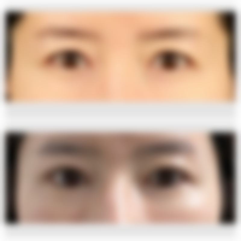 李贵海医生做手术价格