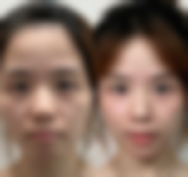 天生的黑眼袋怎么消除:生活习惯——预防胜于治疗