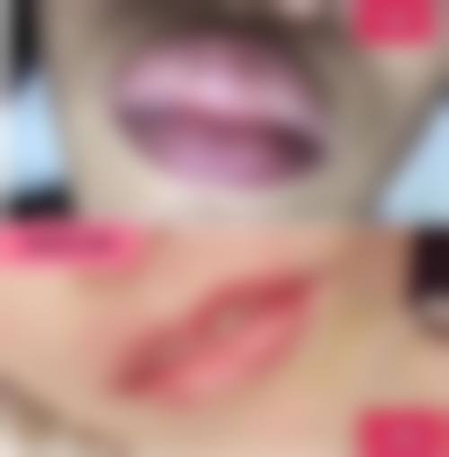 双眼皮怎么去除肉条感之3招消肿秘籍：淋巴按摩大法