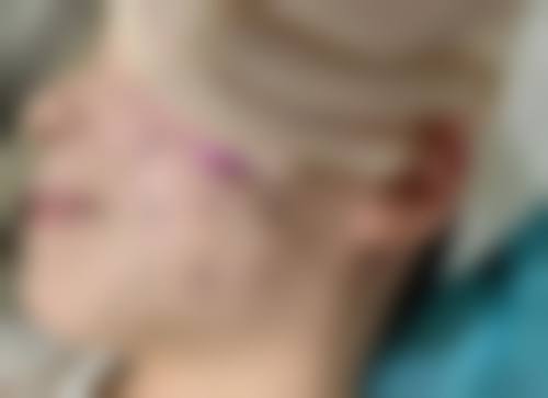 楚雄亚兰整形医疗美容诊所可靠吗