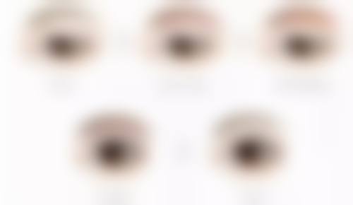 提眉手术修复时间表：从“肿眼泡”到自然眉形的理想蜕变