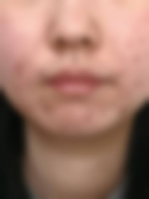 福州优医联合医美医疗美容诊所怎么挂号，地址在哪儿