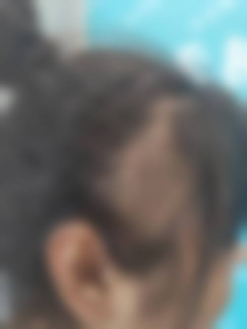 绍兴新生植发怎么样:是否正规