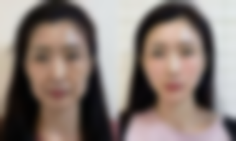 结尾：坚持就是胜利，告别眼袋迎新生