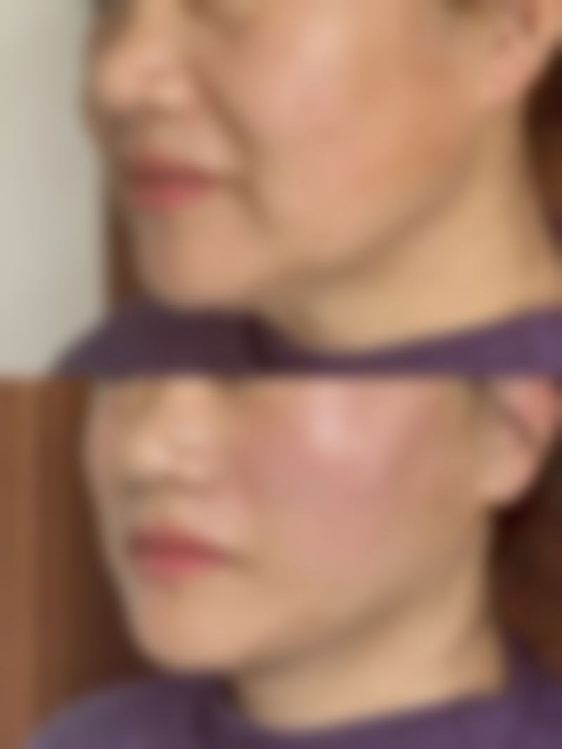 林育如医生项目优势