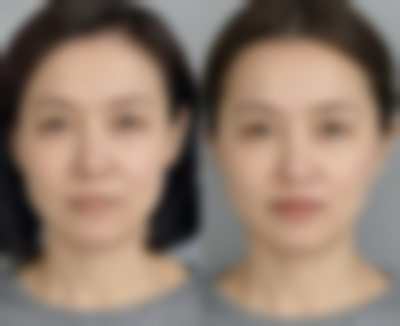 楚雄亚兰整形医疗美容诊所评价