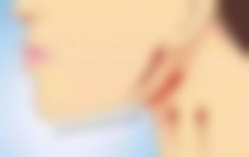 参军身体有手术疤痕可以吗?腹部手术疤痕藏在衣服里的参军秘密