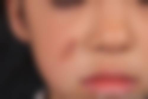 沧州瑞美医疗美容门诊部更擅长什么