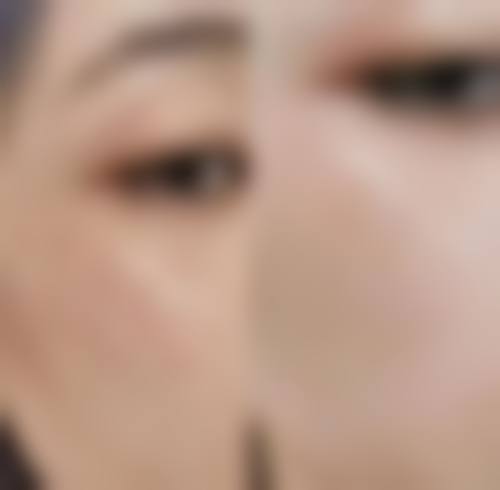 聊城德尔美客医疗美容诊所评价