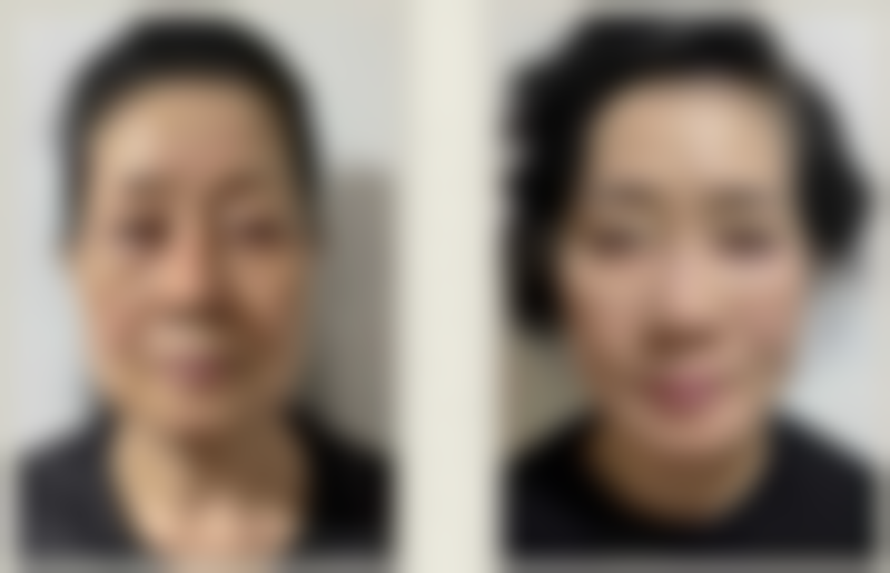 参军身体有手术疤痕可以吗?较大手术疤痕如何争取一线生机