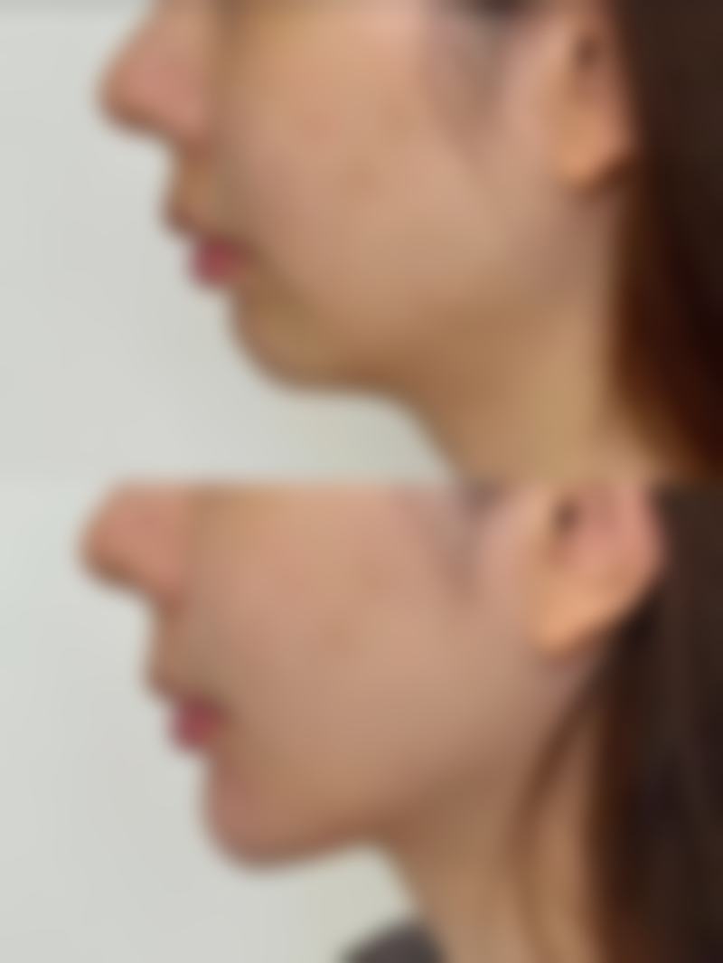 给“准小腰精”们的贴心话