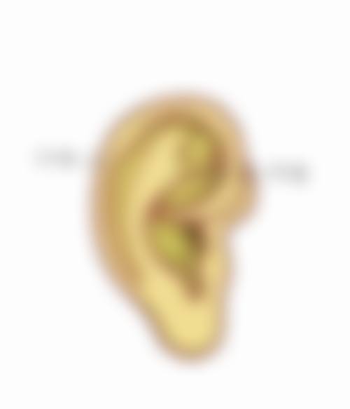 耳软骨隆鼻缺点有哪些——耳软骨供区留疤，美丽背后的代价